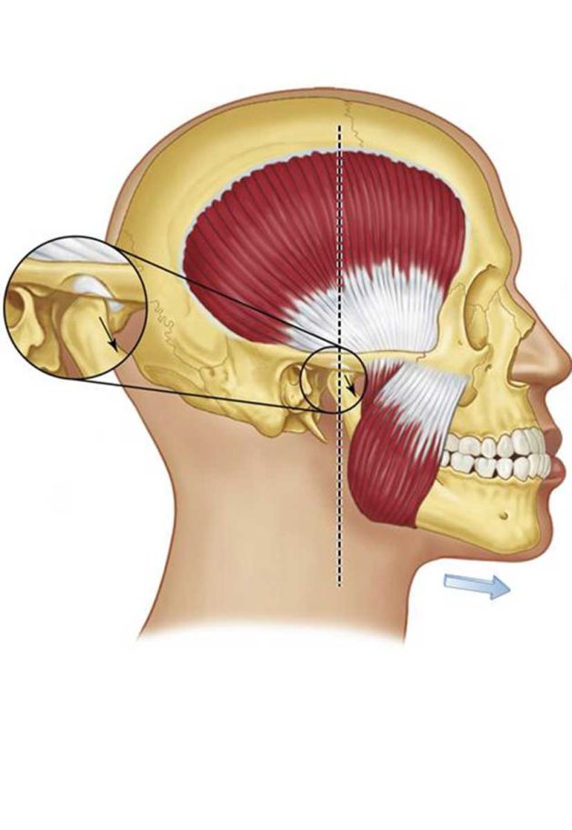 Cura Mal di denti e mandibola Gnatologia